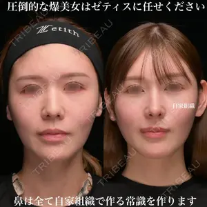 Zetith Beauty Clinic 銀座院 鉄 鑠医師の症例