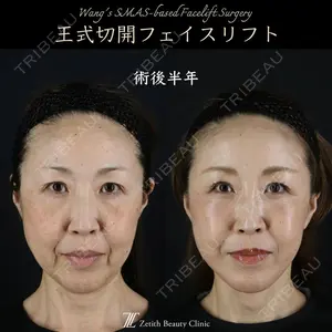 Zetith Beauty Clinic 新宿院 王 蘇医師の症例