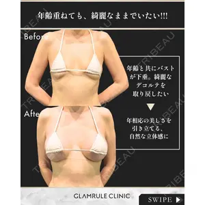 GLAMRULE CLINIC (グラムルール クリニック) 銀座院 藤林 万里子医師の症例