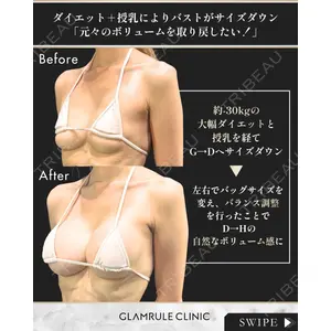 GLAMRULE CLINIC (グラムルール クリニック) 銀座院 藤林 万里子医師の症例