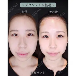 HAAB BEAUTY CLINIC 南青山本院（新院） 小平 佳典医師の症例