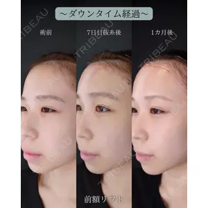HAAB BEAUTY CLINIC 南青山本院（新院） 小平 佳典医師の症例
