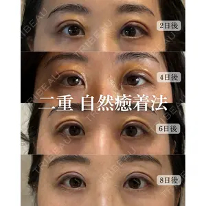 nico wellness デンタルクリニック広尾 佐藤 大晟医師の症例