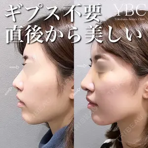 YBC横浜美容外科 池袋院 磯村 亮輔医師の症例