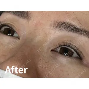 Kinshicho Beauty Clinic （錦糸町ビューティークリニック）の症例