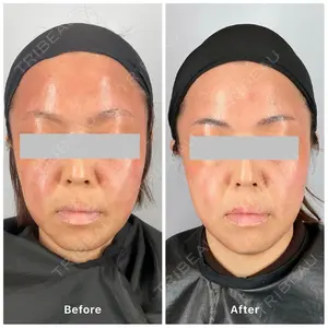 oneUPclinicの症例