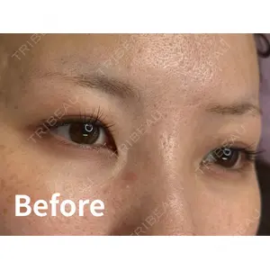 Kinshicho Beauty Clinic （錦糸町ビューティークリニック）の症例