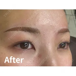 Kinshicho Beauty Clinic （錦糸町ビューティークリニック）の症例