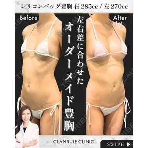 GLAMRULE CLINIC (グラムルール クリニック) 銀座院 藤林 万里子医師の症例