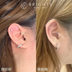 BRIGHTS beauty clinic 今村 直樹医師の症例