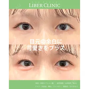 LIBER CLINIC 矢橋 洋一郎医師の症例