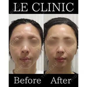 LE CLINICの症例