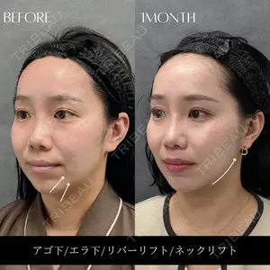 RIVER CLINIC（リバークリニック）大阪院の症例