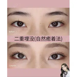 吉祥寺アイビークリニック 巴 窓花医師の症例