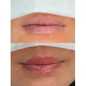 Belle Via Clinic 森田 佑望医師の症例