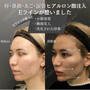 ロレシー美容クリニック 心斎橋駅前院 福留院長医師の症例