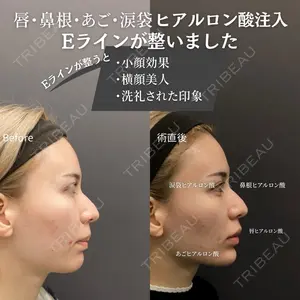ロレシー美容クリニック 心斎橋駅前院 福留院長医師の症例