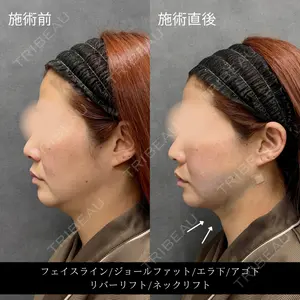RIVER CLINIC（リバークリニック）大阪院の症例