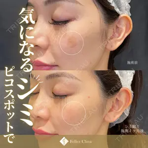Fellez Clinic【フェルズクリニック】の症例