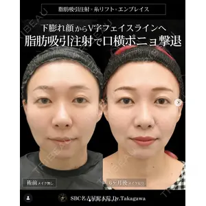 湘南美容クリニック 名古屋駅本院 高川 裕也医師の症例