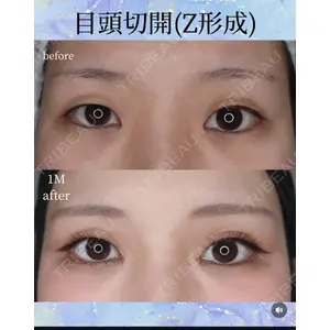 千葉美容外科アイビークリニック 藤田 愛樹医師の症例