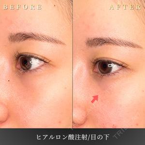 BiBiクリニック 山本 幸一郎医師の症例