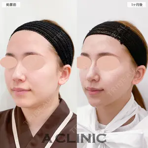 A CLINIC（エークリニック） 大阪院 田窪 賢志郎医師の症例