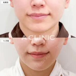 A CLINIC（エークリニック） 大阪院 田窪 賢志郎医師の症例