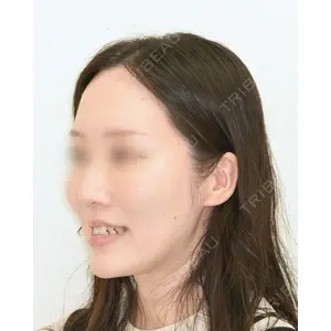 湘南歯科クリニック 横浜院 加藤 由紀子医師の症例