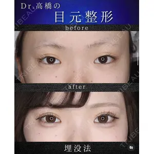 吉祥寺アイビークリニック 高橋 京佑 医師の症例