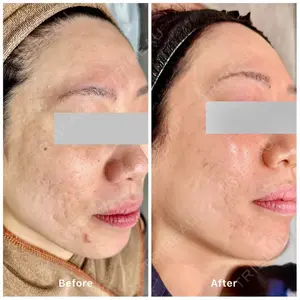 oneUPclinic 笹井 哉臣医師の症例