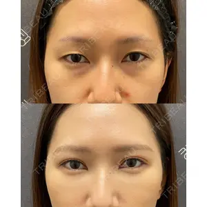EMMO FACE CLINIC 大宮院 廣松 直樹医師の症例