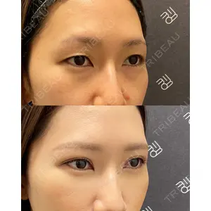 EMMO FACE CLINIC 大宮院 廣松 直樹医師の症例