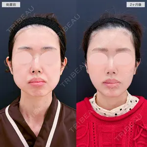 A CLINIC（エークリニック） 仙台院 伊藤 瑠桂医師の症例
