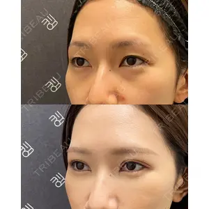 EMMO FACE CLINIC 大宮院 廣松 直樹医師の症例