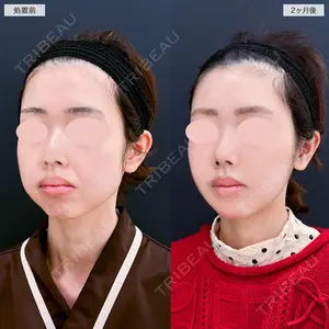 A CLINIC（エークリニック） 仙台院 伊藤 瑠桂医師の症例