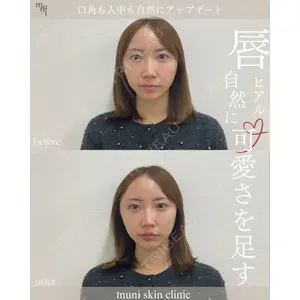 muni skin clinic 高麗 惠理医師の症例
