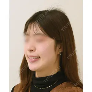 湘南歯科クリニック 横浜院 加藤 由紀子医師の症例