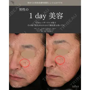 muni skin clinic 高麗 惠理医師の症例