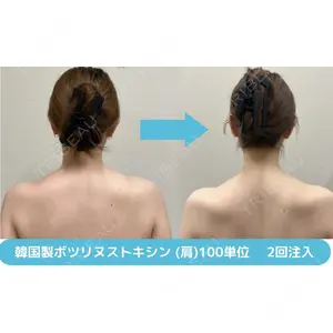 おおたかの森ビューティークリニックthe artの症例