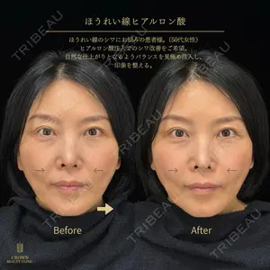 CROWN BEAUTY CLINIC 神山 豊医師の症例