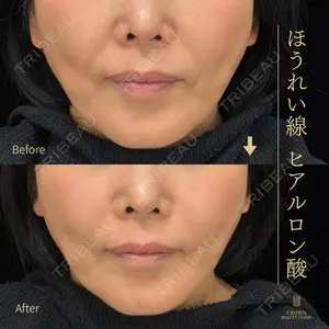 CROWN BEAUTY CLINIC 神山 豊医師の症例