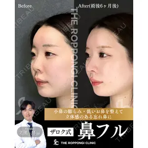 THE ROPPONGI CLINIC（ザ 六本木クリニック） 石黒 昂医師の症例