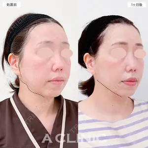A CLINIC（エークリニック） 大阪院 田窪 賢志郎医師の症例