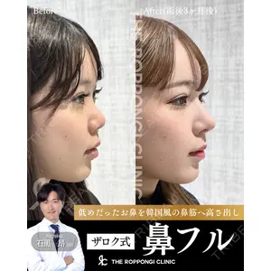 THE ROPPONGI CLINIC（ザ 六本木クリニック） 石黒 昂医師の症例