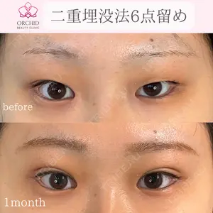 オーキッド美容クリニック東京御徒町 西浦 蘭子医師の症例