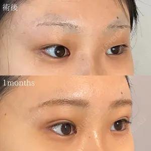 オーキッド美容クリニック東京御徒町 西浦 蘭子医師の症例