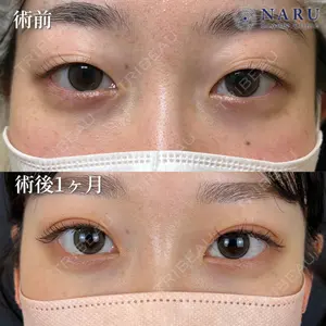 NARU Beauty Clinic 【ナルクリ】 石橋 成彦医師の症例