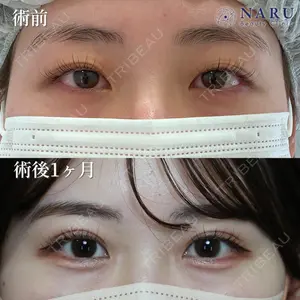 NARU Beauty Clinic 【ナルクリ】 石橋 成彦医師の症例
