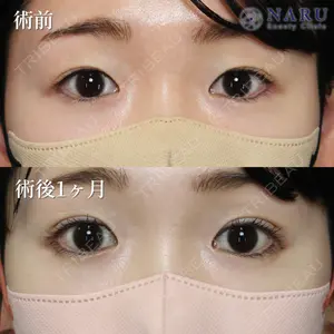 NARU Beauty Clinic 【ナルクリ】 石橋 成彦医師の症例